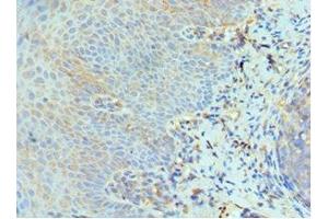 Immunohistochemistry of paraffin-embedded human tonsil tissue using ABIN7151466 at dilution of 1:100 (GCN2 抗体  (AA 1-300))