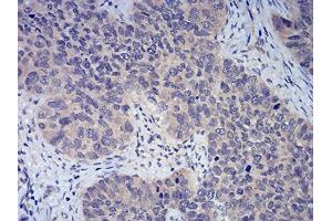 Immunohistochemistry (IHC) image for anti-Forkhead Box P3 (FOXP3) (AA 297-431) antibody (ABIN5542315)