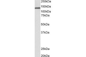 ABIN2564306 (0. (Oncostatin M Receptor 抗体  (Internal Region))