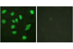 Immunofluorescence (IF) image for anti-V-Myb Myeloblastosis Viral Oncogene Homolog (Avian)-Like 2 (MYBL2) (AA 551-600) antibody (ABIN2888783) (MYBL2 抗体  (AA 551-600))