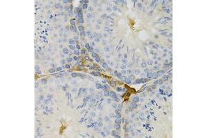 Immunohistochemistry of paraffin-embedded mouse testis using TAPBP Antibody (ABIN5971019) at dilution of 1/200 (40x lens).