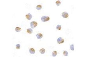 Immunocytochemistry of Bcl-B in Jurkat cells with AP30130PU-N Bcl-B antibody at 10 μg/ml. (BCL2L10 抗体  (N-Term))