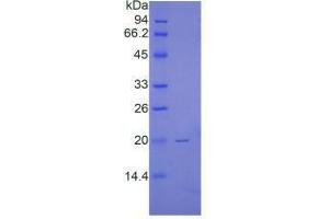 SDS-PAGE analysis of Human Renalase Protein. (RNLS 蛋白)