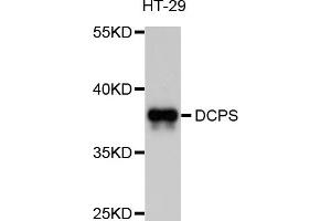 Western blot analysis of extracts of HT-29 cells, using DCPS antibody (ABIN5997562) at 1/1000 dilution. (DCPS 抗体)