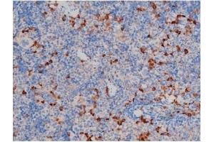 Immunohistochemistry (IHC) image for anti-V-Akt Murine Thymoma Viral Oncogene Homolog 1 (AKT1) (pSer124) antibody (ABIN6256119)
