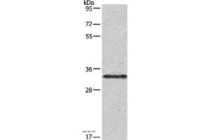Western blot analysis of Jurkat cell, using IL1A Polyclonal Antibody at dilution of 1:666 (IL1A 抗体)