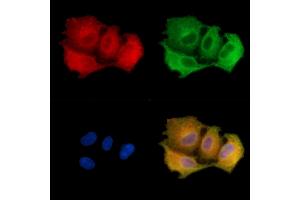 ABIN7095258 and ABIN7099315 staining  cells by IF/ICC.