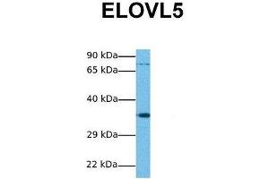 Host:  Rabbit  Target Name:  ELOVL5  Sample Tissue:  Human Jurkat  Antibody Dilution:  1. (ELOVL5 抗体  (N-Term))