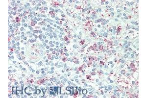 Immunohistochemistry (IHC) image for anti-Protein tyrosine Phosphatase, Receptor Type, B (PTPRB) (AA 1214-1463) antibody (ABIN7444100)