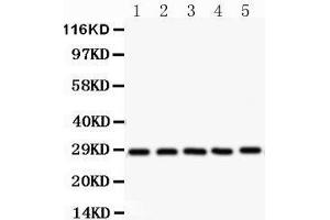Western Blotting (WB) image for anti-serine/arginine-Rich Splicing Factor 1 (SRSF1) (AA 6-33), (N-Term) antibody (ABIN3043296) (SRSF1 抗体  (N-Term))