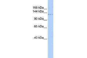 WB Suggested Anti-PHF2 Antibody Titration:  0. (PHF2 抗体  (Middle Region))