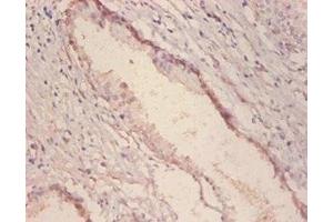 Immunohistochemistry of paraffin embedded human prostate tissue using ABIN7143879 at dilution of 1:100 (GLA 抗体  (AA 32-429))