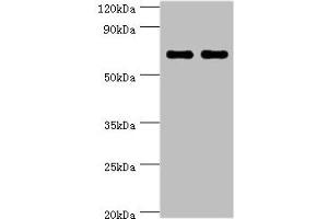 Western blot All lanes: BIRC2 antibody at 5 μg/mL Lane 1: HepG2 whole cell lysate Lane 2: K562 whole cell lysate Secondary Goat polyclonal to rabbit IgG at 1/10000 dilution Predicted band size: 70, 65 kDa Observed band size: 70 kDa (BIRC2 抗体  (AA 1-300))