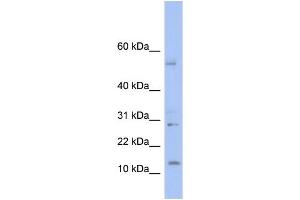 WB Suggested Anti-TD1 Antibody Titration: 0. (TLX1 Neighbor 抗体  (Middle Region))