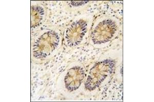 Image no. 4 for anti-Aldo-Keto Reductase Family 1, Member B1 (Aldose Reductase) (AKR1B1) (AA 287-316), (C-Term) antibody (ABIN357880)