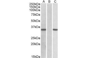 HEK293 lysate (10ug protein in RIPA buffer) overexpressing Human CRISP2 with C-terminal MYC tag probed with ABIN2562009 (0. (CRISP2 抗体  (AA 77-89))
