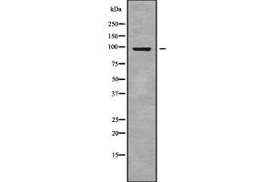 Western blot analysis GPLD1 using K562 whole cell lysates (GPLD1 抗体  (Internal Region))