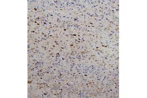IHC analysis of RET using anti-RET antibody (ABIN6719502). (Ret Proto-Oncogene 抗体  (AA 29-304))
