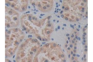 DAB staining on IHC-P; Samples: Human Kidney Tissue (CELSR3 抗体  (AA 1181-1421))