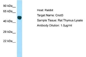 Host: Rabbit Target Name: Cnot3 Sample Type: Rat Thymus lysates Antibody Dilution: 1. (CNOT3 抗体  (Middle Region))