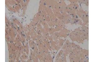IHC-P analysis of Rat Heart Tissue, with DAB staining. (ICAM2 抗体  (AA 29-247))