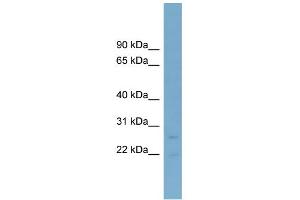 WB Suggested Anti-NT5M Antibody Titration: 0. (NT5M 抗体  (Middle Region))