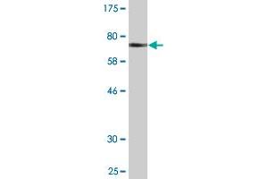 Western Blot detection against Immunogen (71. (PSTPIP1 抗体  (AA 1-416))