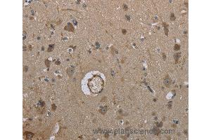 Immunohistochemistry of Human brain using MARK4 Polyclonal Antibody at dilution of 1:40 (MARK4 抗体)