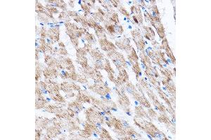 Immunohistochemistry of paraffin-embedded Rat heart using L Rabbit pAb (ABIN7268192) at dilution of 1:100 (40x lens). (LATS2 抗体  (AA 1-100))