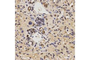 Immunohistochemistry (IHC) image for anti-Family with Sequence Similarity 160, Member B2 (FAM160B2) antibody (ABIN1872648) (FAM160B2 抗体)