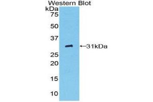 Western Blotting (WB) image for anti-Pyridoxal Kinase (PDXK) (AA 35-251) antibody (ABIN1860180)