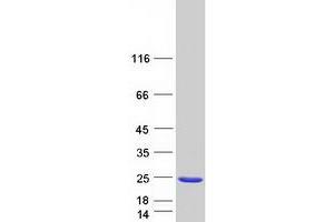 Western Blotting (WB) image for NudC Domain Containing 2 (NUDCD2) protein (Myc-DYKDDDDK Tag) (ABIN2727718)
