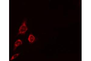 ABIN6274718 staining HepG2 cells by IF/ICC. (MRPS16 抗体)