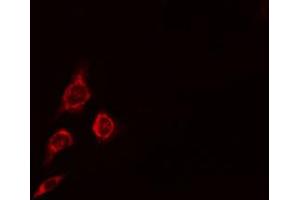 ABIN6274718 staining HepG2 cells by IF/ICC.