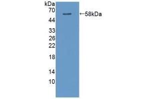 Detection of Recombinant CAMK2a, Rat using Polyclonal Antibody to Calcium/Calmodulin Dependent Protein Kinase II Alpha (CAMK2a) (CAMK2A 抗体  (AA 1-478))