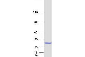 Western Blotting (WB) image for RAB35, Member RAS Oncogene Family (RAB35) protein (Myc-DYKDDDDK Tag) (ABIN2730331)