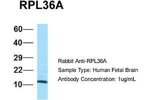 Host: Rabbit  Target Name: RPL36A  Sample Tissue: Human Fetal Brain  Antibody Dilution: 1. (RPL36AL 抗体  (C-Term))
