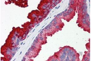 Human Prostate: Formalin-Fixed, Paraffin-Embedded (FFPE) (RAB23 抗体  (AA 35-84))