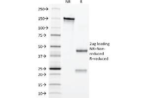 SDS-PAGE Analysis Purified Erythropoietin (EPO) Mouse Monoclonal Antibody (EPO/1367). (EPO 抗体  (AA 28-162))