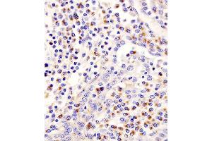 Immunohistochemistry (Paraffin-embedded Sections) (IHC (p)) image for anti-Lipoprotein-Associated phospholipase A2 (Lp-PLA2) (AA 200-228) antibody (ABIN653776)