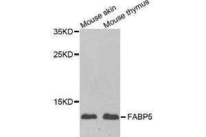 Western blot analysis of extracts of mouse skin and mouse thymus using FABP5 antibody. (FABP5 抗体)