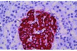 Human Pancreas, Islets of Langerhans: Formalin-Fixed, Paraffin-Embedded (FFPE) (Insulin 抗体)