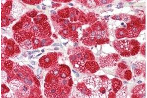Immunohistochemistry (IHC) image for anti-Cytochrome P450, Family 21, Subfamily A, Polypeptide 2 (CYP21A2) (AA 314-363) antibody (ABIN6753003)