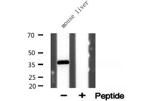 Western blot analysis of extracts from mouse liver, using AKR1CL2 antibody. (AKR1E2 抗体  (Internal Region))
