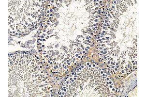 ABIN6257772 and ABIN6274836 at 1/100 staining rat testis tissue by IHC-P.