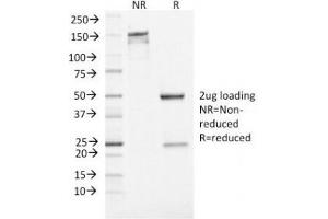 SDS-PAGE Analysis of Purified, BSA-Free Neuron Specific Enolase Antibody (clone ENO2/1462). (ENO2/NSE 抗体  (AA 416-433))