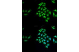 Immunofluorescence analysis of MCF7 cells using KLK4 antibody (ABIN6131853, ABIN6142954, ABIN6142955 and ABIN6222339). (Kallikrein 4 抗体  (AA 30-254))