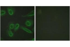 Immunofluorescence analysis of HeLa cells, using PECAM-1 (Ab-713) Antibody. (CD31 抗体  (AA 686-735))