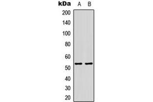 Western blot analysis of p53 (AcK386) expression in HepG2 (A), H9C2 (B) whole cell lysates. (p53 抗体  (acLys386, C-Term))