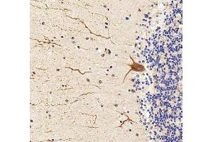IHC analysis of SIGMAR1 using anti-SIGMAR1 antibody (ABIN7599011).